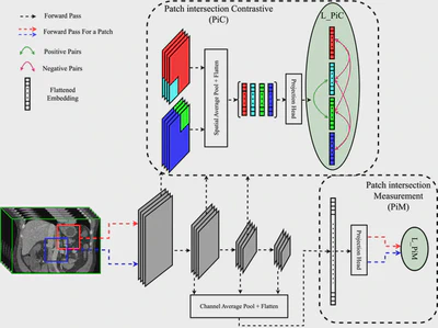 Self-Supervised Learning for 3D Patch-Based Medical Image Segmentation featured image