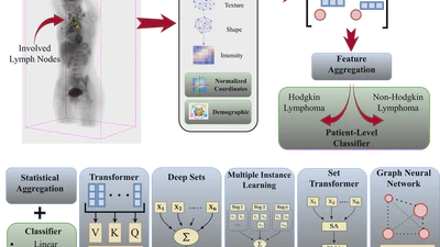 Revisiting Multi-Nodal Radiomics with Advanced Feature Learning for Lymphoma Classification: A Multi-Center Study featured image