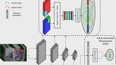 PiMPiC: An Overlap-Aware Contrastive Learning Framework for 3D Patch-Based Medical Image Segmentation featured image